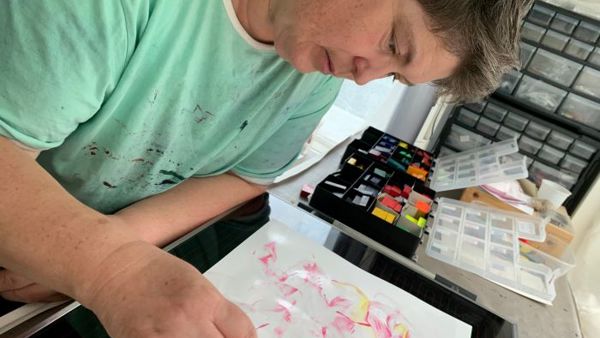 Rachel-Kuipers-ervaringsdeskundige-nystagmus-staar-kunst-schilderij.jpg Rachel-Kuipers-ervaringsdeskundige-nystagmus-staar-kunst-schilderij.jpg