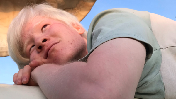 Een foto van Jing. Hij ligt met zijn hoofd op zijn armen en kijkt weg van de camera. Een foto van Jing. Hij ligt met zijn hoofd op zijn armen en kijkt weg van de camera.