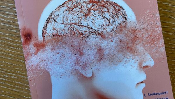 Afbeelding van het boek "Visuele stoornissen bij niet-aangeboren Hersenletsel". Op de voorkant staat een dwarsdoorsnede van een hoofd, met een mist voor de ogen en door een deel van het brein. Afbeelding van het boek "Visuele stoornissen bij niet-aangeboren Hersenletsel". Op de voorkant staat een dwarsdoorsnede van een hoofd, met een mist voor de ogen en door een deel van het brein.