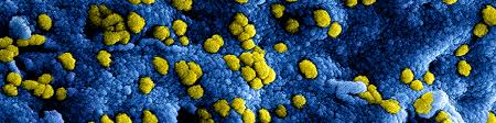 Coronavirus. Hobbelige blauwe ondergrond met gele bolletjes Coronavirus. Hobbelige blauwe ondergrond met gele bolletjes